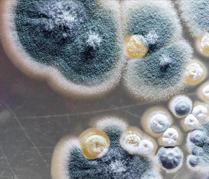 Microscopic photo of Mold